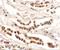 Dispatched RND Transporter Family Member 1 antibody, A11542, Boster Biological Technology, Immunohistochemistry frozen image 