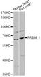 PR/SET Domain 11 antibody, LS-C749155, Lifespan Biosciences, Western Blot image 