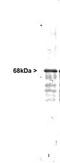 Neurofilament Light antibody, PA3-16719, Invitrogen Antibodies, Western Blot image 