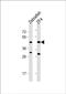 Pyruvate Dehydrogenase E1 Alpha 1 Subunit antibody, PA5-72684, Invitrogen Antibodies, Western Blot image 
