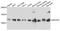 NADH:Ubiquinone Oxidoreductase Subunit A5 antibody, A3976, ABclonal Technology, Western Blot image 