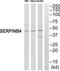 Serpin Family B Member 4 antibody, TA313038, Origene, Western Blot image 