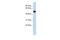 Translocation Associated Membrane Protein 1 Like 1 antibody, PA5-43932, Invitrogen Antibodies, Western Blot image 