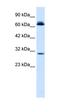 Sirtuin 3 antibody, orb329655, Biorbyt, Western Blot image 