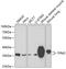 Tropomyosin 2 antibody, 18-940, ProSci, Western Blot image 