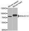 Sialic Acid Binding Ig Like Lectin 12 (Gene/Pseudogene) antibody, A8519, ABclonal Technology, Western Blot image 