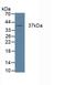 Cathepsin K antibody, LS-C293262, Lifespan Biosciences, Western Blot image 