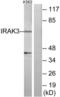Interleukin 1 Receptor Associated Kinase 3 antibody, LS-C119352, Lifespan Biosciences, Western Blot image 