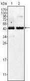 Alpha-Methylacyl-CoA Racemase antibody, MA5-15360, Invitrogen Antibodies, Western Blot image 