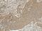 Cyclin D1 antibody, LS-C776403, Lifespan Biosciences, Immunohistochemistry paraffin image 
