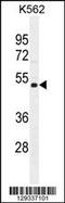 Nudix Hydrolase 19 antibody, 55-878, ProSci, Western Blot image 