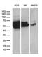 Dihydropyrimidinase Like 2 antibody, LS-C792847, Lifespan Biosciences, Western Blot image 
