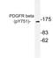 Platelet Derived Growth Factor Receptor Beta antibody, LS-C178098, Lifespan Biosciences, Western Blot image 