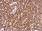 Protein Phosphatase With EF-Hand Domain 2 antibody, GTX102536, GeneTex, Immunohistochemistry paraffin image 