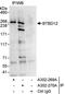 SLX4 Structure-Specific Endonuclease Subunit antibody, A302-270A, Bethyl Labs, Immunoprecipitation image 