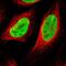 Histone Deacetylase 2 antibody, NBP1-87109, Novus Biologicals, Immunofluorescence image 