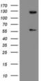 Ubiquitin Specific Peptidase 54 antibody, NBP2-45403, Novus Biologicals, Western Blot image 