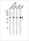 3-Hydroxy-3-Methylglutaryl-CoA Synthase 2 antibody, 62-469, ProSci, Western Blot image 