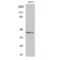 Potassium Voltage-Gated Channel Subfamily A Regulatory Beta Subunit 3 antibody, LS-C384292, Lifespan Biosciences, Western Blot image 