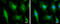 Cortactin antibody, GTX100253, GeneTex, Immunocytochemistry image 