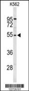 Ribosomal Protein S6 Kinase B2 antibody, 63-338, ProSci, Western Blot image 