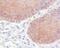 Keratin 5 antibody, 32-142, ProSci, Immunohistochemistry frozen image 