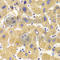 Kinesin Family Member 1B antibody, A6638, ABclonal Technology, Immunohistochemistry paraffin image 