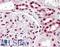 Interferon Regulatory Factor 6 antibody, LS-B3231, Lifespan Biosciences, Immunohistochemistry paraffin image 
