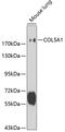 Collagen Type V Alpha 1 Chain antibody, GTX32530, GeneTex, Western Blot image 
