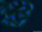 AKT Interacting Protein antibody, 14860-1-AP, Proteintech Group, Immunofluorescence image 