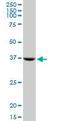 Syntaxin 18 antibody, orb95214, Biorbyt, Western Blot image 