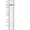 Sodium Voltage-Gated Channel Alpha Subunit 9 antibody, PA5-67651, Invitrogen Antibodies, Western Blot image 