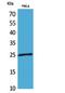 Peroxiredoxin 1 antibody, STJ96820, St John