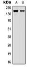 Membrane Associated Guanylate Kinase, WW And PDZ Domain Containing 2 antibody, abx121461, Abbexa, Western Blot image 