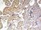 Inhibin Subunit Beta B antibody, NBP2-12010, Novus Biologicals, Immunohistochemistry paraffin image 