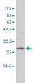 AlkB Homolog 3, Alpha-Ketoglutaratedependent Dioxygenase antibody, H00221120-M01, Novus Biologicals, Western Blot image 