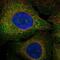 Fms Related Tyrosine Kinase 3 antibody, NBP2-57187, Novus Biologicals, Immunocytochemistry image 