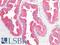 Acid Phosphatase, Prostate antibody, LS-B16883, Lifespan Biosciences, Immunohistochemistry paraffin image 