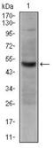 TNF Receptor Superfamily Member 8 antibody, GTX60555, GeneTex, Western Blot image 