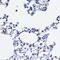 Ubiquitin Conjugating Enzyme E2 L3 antibody, GTX33568, GeneTex, Immunohistochemistry paraffin image 
