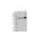 Aryl Hydrocarbon Receptor antibody, PA1782-1, Boster Biological Technology, Western Blot image 