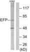 E3 ubiquitin/ISG15 ligase TRIM25 antibody, abx013601, Abbexa, Western Blot image 