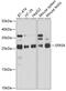 Serine And Arginine Rich Splicing Factor 9 antibody, GTX64863, GeneTex, Western Blot image 