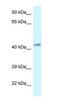Mitochondrial Trans-2-Enoyl-CoA Reductase antibody, NBP1-79910, Novus Biologicals, Western Blot image 