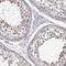 CWF19 Like Cell Cycle Control Factor 1 antibody, NBP1-83793, Novus Biologicals, Immunohistochemistry paraffin image 