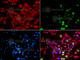 Tumor Protein P53 Binding Protein 1 antibody, A5757, ABclonal Technology, Immunofluorescence image 