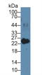 Myosin Light Chain 3 antibody, abx104657, Abbexa, Western Blot image 