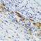 USO1 Vesicle Transport Factor antibody, 18-816, ProSci, Immunohistochemistry paraffin image 