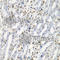 TNF Superfamily Member 10 antibody, A2138, ABclonal Technology, Immunohistochemistry paraffin image 