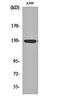 Janus Kinase 1 antibody, orb159557, Biorbyt, Western Blot image 